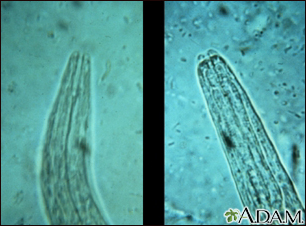 Hookworm - mouth of the organism