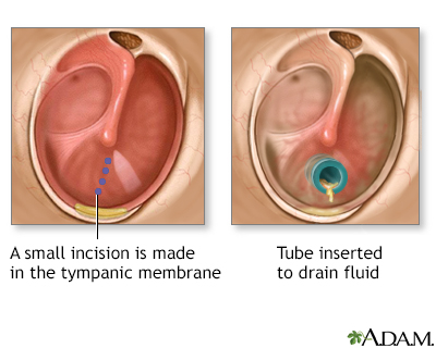 Procedure