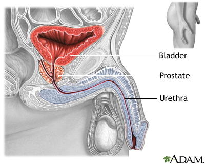 Prostatectomy - series - Normal anatomy