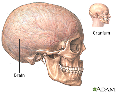 Craniotomy - series