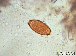 Trichuris trichiura egg