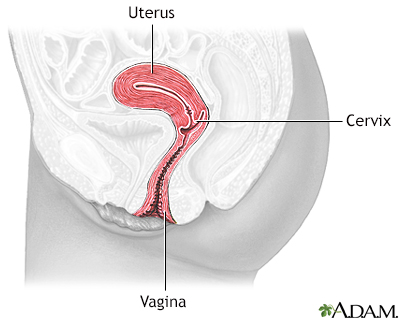 Cervical dysplasia - series