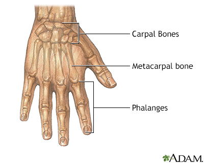 Repair of webbed fingers - series