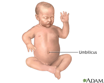 Umbilical hernia repair - series - Normal anatomy