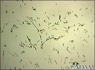 Campylobacter jejuni organism