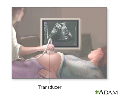 Ultrasound in pregnancy