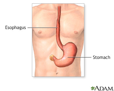 Gastrostomy tube placement - series