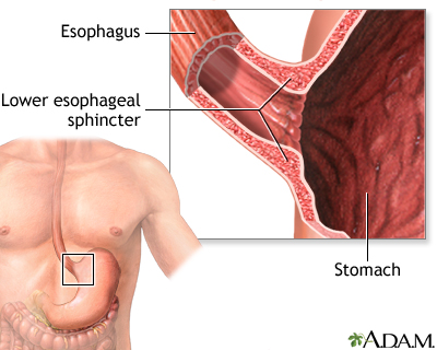 Achalasia - series