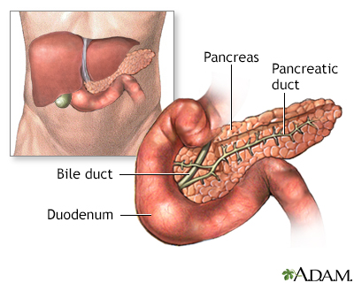 Pancreatitis - series