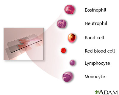 Complete blood count - series - Indication