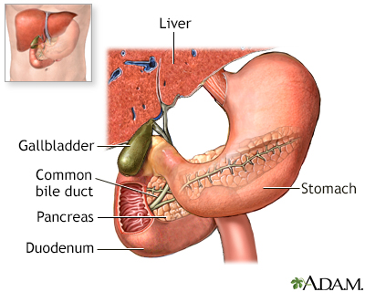 Endoscopic retrograde cholangio pancreatography (ERCP) - series