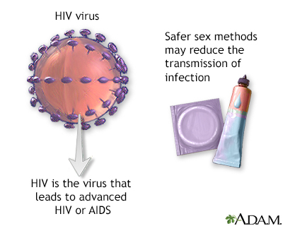 HIV