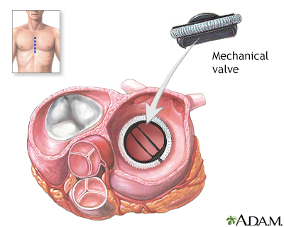 Procedure, part 3