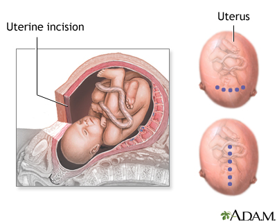 Procedure, part 3