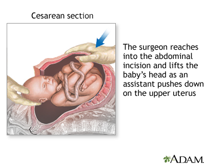 Procedure, part 5