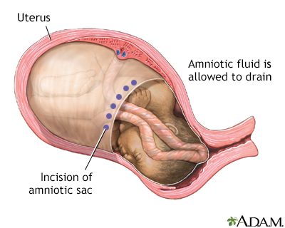 Procedure, part 4