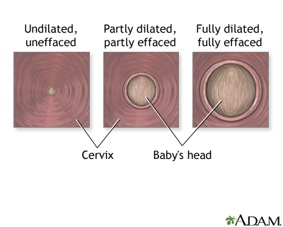 Procedure, part 3