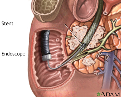 Procedure