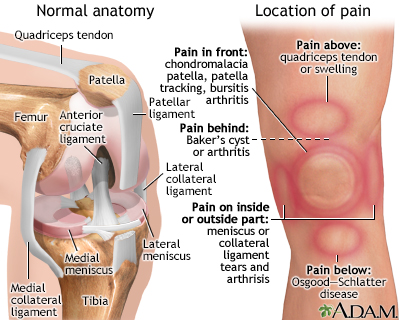 Knee pain