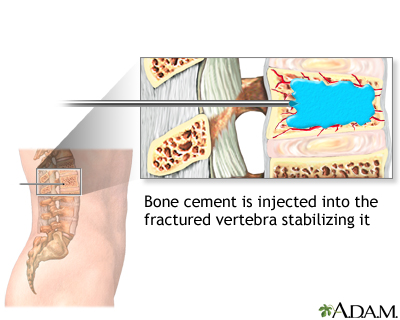 Procedure