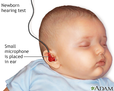 Hearing test