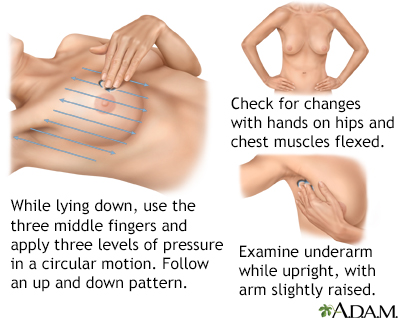 Breast self-exam