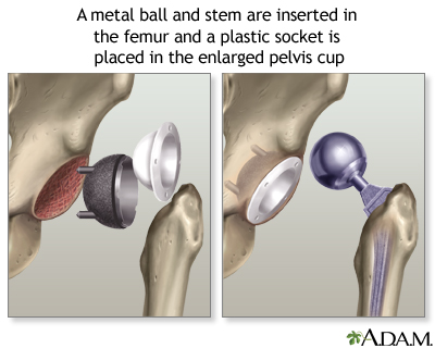 Procedure, part 2