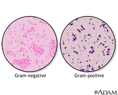 Gram stain