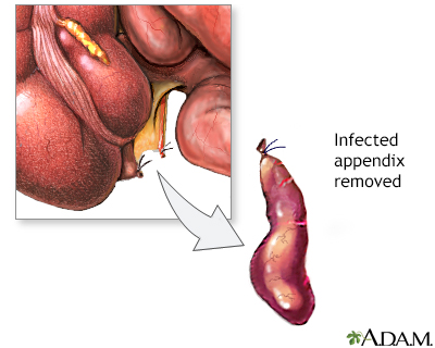 Procedure