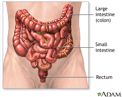 Colostomy - series