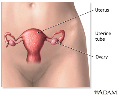 Hysterectomy - Series