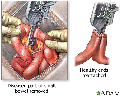 Procedure