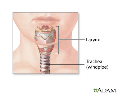 Tracheostomy - series