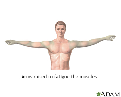 Muscle fatigue