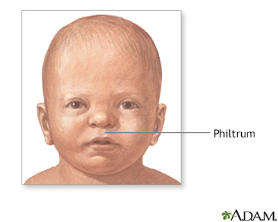 Philtrum