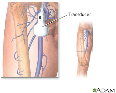 Doppler ultrasonography of an extremity