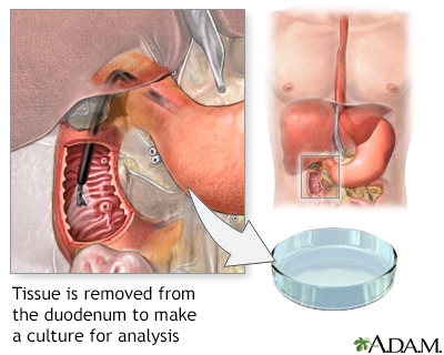 Duodenal tissue culture