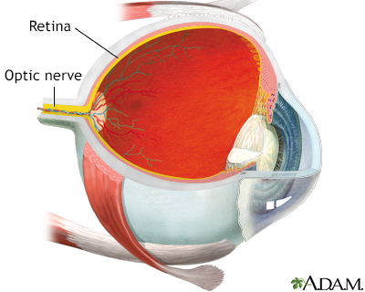 Retina