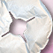 Breast engorgement