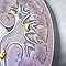 Kidney stones