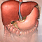 Hepatitis B