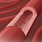 Health risks of hyperlipidemia