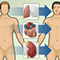 Heart transplant - overview
