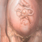 C-section