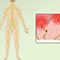 Nociceptive pain