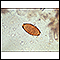 Trichuris trichiura egg