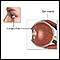 Eye muscle repair - normal anatomy