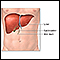 Liver transplant - series