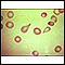 Red blood cells, tear-drop shape