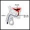 Inflatable artificial sphincter - series - Normal anatomy